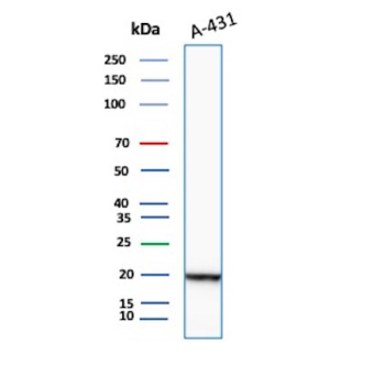 Recombinant FTL Antibody A-431 WB. Western blot analysis of A-431 cell lysate using recombinant FTL Antibody detects a strong band at approximately 20 kDa, consistent with ferritin light chain / FTL. The observed signal supports expression of this intracellular iron storage protein in epithelial-derived tumor cells and aligns with the established role of FTL in ferritin complex assembly, iron sequestration, oxidative stress regulation, and cellular iron homeostasis pathways.