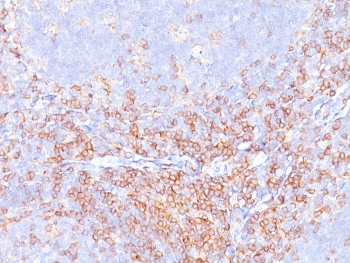 CD4 Antibody for IHC. Analysis of CD4 antibody staining in FFPE human tonsil tissue shows strong membranous labeling of CD4-positive T helper lymphocytes within interfollicular regions and surrounding lymphoid follicles, highlighting T cell-rich zones within lymphoid tissue. The selective staining pattern supports the high specificity profile of this microarray specificity validated clone CD4/3619R. Heat-induced epitope retrieval was performed by boiling tissue sections in pH 9 10 mM Tris with 1 mM EDTA for 20 minutes followed by cooling before testing.