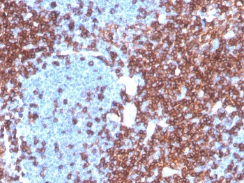 IHC staining of FFPE human lymph node with recombinant microarray validated CD4 antibody. HIER: boil tissue sections in pH 9 10mM Tris with 1mM EDTA for 20 min and allow to cool before testing.