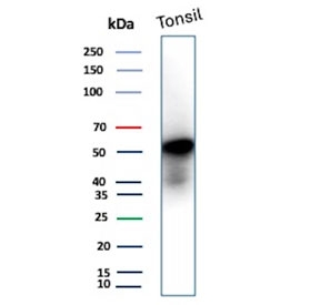 Western blot testing of human tonsil tissue lysate with recombinant CD4 antibody. Expected molecular weight: 50-55 kDa.