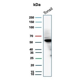 Western blot testing of human tonsil tissue lysate with recombinant CD4 antibody. Expected molecular weight: 50-55 kDa.