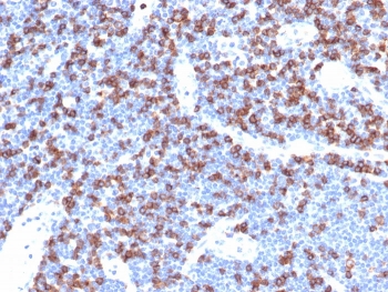 CD8A Antibody Lymph Node IHC. Immunohistochemistry analysis of CD8 alpha (CD8A) in FFPE human lymph node tissue shows strong membranous staining of abundant cytotoxic T lymphocytes within lymphoid regions, consistent with expected localization of CD8-positive T cells in secondary lymphoid tissue and supporting identification of immune cell populations in a densely cellular microenvironment. Human protein microarray specificity validated antibody performance supports high-confidence, target-selective detection in immune-rich tissues (clone CD8/4391R). Heat-induced epitope retrieval was performed in pH 9 10 mM Tris with 1 mM EDTA for 20 minutes followed by cooling prior to antibody incubation.