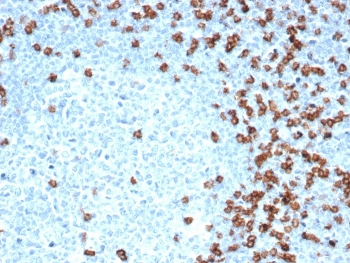CD8A Antibody Tonsil IHC. Immunohistochemistry analysis of CD8 alpha (CD8A) in FFPE human tonsil tissue shows strong membranous staining of cytotoxic T lymphocytes distributed within lymphoid regions, consistent with expected localization of CD8-positive T cells and supporting identification of immune cell populations in secondary lymphoid tissue. Human protein microarray specificity validated antibody performance supports high-confidence, target-selective detection in immune-rich samples (clone CD8/4391R). Heat-induced epitope retrieval was performed in pH 9 10 mM Tris with 1 mM EDTA for 20 minutes followed by cooling prior to antibody incubation.