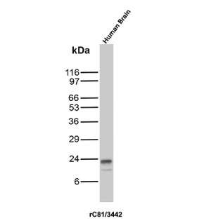 CD81 Antibody Human Brain WB. Western blot analysis of human brain tissue lysate using CD81 Antibody, clone rC81/3442. A prominent band is detected at approximately 22â24 kDa, consistent with the expected molecular weight of CD81. This CD81 Antibody, also called a TAPA-1 Antibody, demonstrates detection of CD81 in human brain tissue and supports studies of tetraspanin membrane organization, cell signaling and cellular communication.