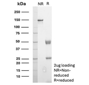 CD81 Antibody Recombinant mAb Purity SDS-PAGE. SDS-PAGE analysis of purified CD81 Antibody, clone rC81/3442, under non-reducing (NR) and reducing (R) conditions with 2 ug of antibody loaded per lane. The non-reduced antibody migrates predominantly at approximately 150 kDa, while reduction produces bands corresponding to the immunoglobulin heavy and light chains at approximately 50 and 25 kDa, respectively. The results confirm the purity and structural integrity of this recombinant CD81 Antibody, also called a TAPA-1 Antibody.