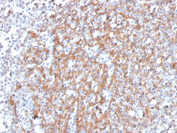 Cystatin A Antibody Prostate Tissue IHC. Immunohistochemistry of Cystatin A / CSTA in FFPE human prostate tissue using mouse monoclonal Cystatin A antibody, clone CSTA/3553. HRP-DAB brown staining highlights cytoplasmic labeling of epithelial cell populations within glandular structures, consistent with intracellular protease inhibitor expression, while surrounding stromal cells show lower staining and nuclei are counterstained blue. Heat induced epitope retrieval was performed by boiling tissue sections in pH 9 10 mM Tris with 1 mM EDTA for 20 min followed by cooling prior to staining.