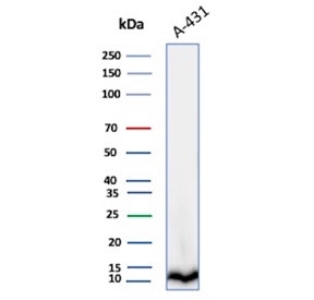 Cystatin A Antibody A431 WB. Western blot analysis of Cystatin A / CSTA in human A431 cell lysate using mouse monoclonal Cystatin A antibody, clone CSTA/3553. A band is detected at approximately 11 kDa, consistent with the predicted molecular weight of CSTA, supporting detection of this intracellular cysteine protease inhibitor in epithelial-derived cells.