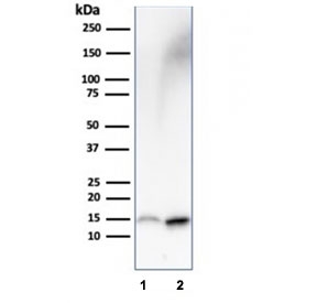 FABP1 Antibody HepG2 and Kidney WB. Western blot analysis of human 1) HepG2 and 2) kidney lysates using FABP1 antibody. A band is detected at approximately 14 kDa, consistent with the predicted molecular weight of Fatty acid-binding protein 1 / FABP1. Enhanced signal in HepG2 cells is consistent with the known enrichment of this intracellular fatty acid-binding and lipid transport protein in hepatocyte-derived cells.