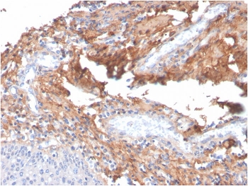 Fibronectin Antibody Human Tonsil Tissue IHC. Immunohistochemistry staining of FFPE human tonsil with Fibronectin antibody (clone C6F10). HIER: boil tissue sections in pH 9 10mM Tris with 1mM EDTA for 20 min and allow to cool before testing.