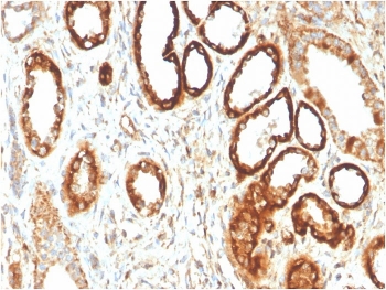 FABP1 Antibody Human Kidney Immunohistochemistry. IHC staining of FFPE human kidney with FABP1 antibody. HIER: boil tissue sections in pH 9 10mM Tris with 1mM EDTA for 20 min and allow to cool before testing.