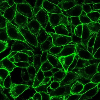 Endoglin Antibody HeLa IF. Immunofluorescence analysis of PFA-fixed human HeLa cells using Endoglin Antibody (green) demonstrates prominent membranous staining outlining cell borders, consistent with CD105 / Endoglin expression as a cell surface angiogenesis-associated marker.
