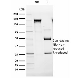 SDS-PAGE analysis of purified, BSA-free Endoglin antibody (clone ENG/1621) as confirmation of integrity and purity.