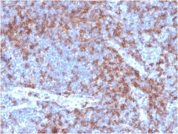 CD22 Antibody Human Tonsil IHC. Immunohistochemistry analysis of CD22/Siglec-2 expression in FFPE human tonsil tissue using recombinant CD22 Antibody / B Cell Receptor Signaling Regulator Antibody clone BLCAM/2637R. Strong HRP-DAB brown membranous and cytoplasmic staining is observed in germinal center and mantle zone B lymphocytes, highlighting dense B cell populations involved in antigen-driven immune responses, while surrounding stromal and non-lymphoid cells remain largely negative. The staining pattern reflects CD22 function as a regulator of B cell receptor signaling and supports use of this CD22 antibody for immunohistochemistry-based evaluation of B cell activation and signaling context in lymphoid tissues. Heat-induced epitope retrieval was performed in pH 9 Tris-EDTA buffer for 20 minutes followed by cooling prior to antibody incubation.