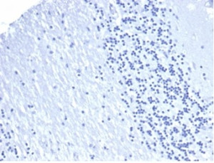 PD-L1 Antibody Negative Control: IHC staining of FFPE human brain tissue with recombinant mouse PD-L1 antibody (clone rPDL1/4772). HIER: boil tissue sections in pH 9 10mM Tris with 1mM EDTA for 20 min and allow to cool before testing.