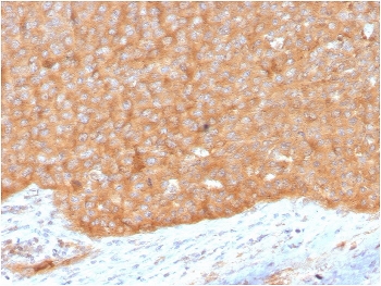 HSP90AB1 Antibody Human Pancreas IHC. Immunohistochemistry analysis of FFPE human pancreas tissue using HSP90AB1 Antibody / Molecular Chaperone Antibody (clone HSP90AB1/3951). Heat induced antigen retrieval was performed by boiling tissue sections in pH 9 Tris-EDTA buffer for 20 minutes prior to staining. Strong diffuse cytoplasmic staining is observed throughout pancreatic epithelial cells, consistent with the constitutive expression of HSP90AB1 as an ATP-dependent molecular chaperone involved in protein folding and cellular protein homeostasis. These results support the use of HSP90AB1 Antibody / Molecular Chaperone Antibody, a Protein Microarray Validated mouse monoclonal antibody, for studying HSP90AB1 expression, molecular chaperone function and protein homeostasis.