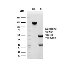 SDS-PAGE analysis of purified, BSA-free HSP90AB1 antibody as confirmation of integrity and purity.