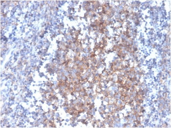 Fas Ligand Antibody Tonsil IHC. Immunohistochemistry analysis of Fas ligand / FASLG expression in FFPE human tonsil tissue using mouse monoclonal antibody clone FASLG/4455. HRP-DAB brown staining is observed in scattered lymphocytes within interfollicular regions and germinal center-associated areas, showing predominantly cytoplasmic and membranous localization, while surrounding stromal elements remain largely negative; nuclei are counterstained blue. Antigen retrieval was performed by boiling sections in 10 mM Tris buffer with 1 mM EDTA, pH 9, for 20 min followed by cooling at room temperature.