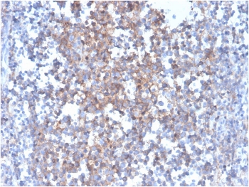 Fas Ligand Antibody Human Tonsil Tissue IHC. Immunohistochemical detection of Fas ligand / CD95L expression in formalin-fixed, paraffin-embedded human tonsil using FASLG antibody, clone FASLG/4455. Distinct HRP-DAB brown signal highlights subsets of activated lymphocytes with cytoplasmic and membranous staining patterns, particularly within lymphoid compartments, while background staining remains minimal; nuclei are counterstained blue. Heat-induced epitope retrieval was carried out in pH 9 Tris-EDTA buffer for 20 min with subsequent cooling prior to staining.