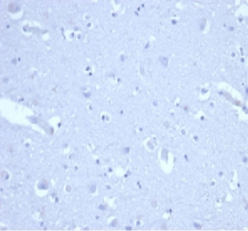 p21 / p21WAF1 Antibody Brain Tissue Negative Control IHC. Immunohistochemistry staining of FFPE human brain tissue with recombinant p21 antibody (clone CIP1/4377R). HIER: boil tissue sections in pH 9 10mM Tris with 1mM EDTA for 20 min and allow to cool before testing.