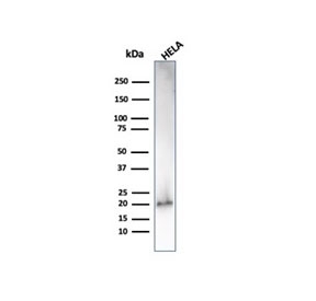 Western blot testing of human HeLa cell lysate with recombinant p21 antibody (clone CIP1/4377R).