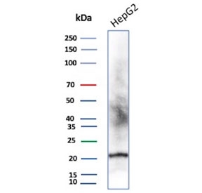 Western blot testing of human HepG2 cell lysate with recombinant p21 antibody (clone CIP1/4377R).