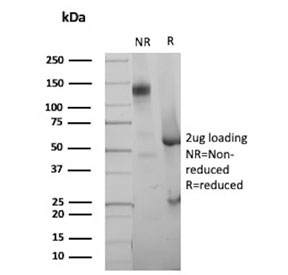 SDS-PAGE analysis of purified, BSA-free recombinant p21 antibody (clone CIP1/4377R) as confirmation of integrity and purity.