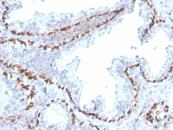 p40 Antibody. Immunohistochemistry analysis of Tumor protein p40 (deltaNp63) in FFPE human kidney tissue using a p40 antibody (clone rTP40/3690) demonstrates distinct HRP-DAB brown nuclear staining in epithelial cells lining tubular structures, while surrounding stromal and non-epithelial cells remain largely negative. The nuclear-restricted staining pattern is consistent with the localization of deltaNp63 as a transcription factor and highlights epithelial cell compartments within the kidney. Heat-induced epitope retrieval was performed by boiling tissue sections in pH 9 10mM Tris with 1mM EDTA for 20 minutes followed by cooling prior to antibody incubation.