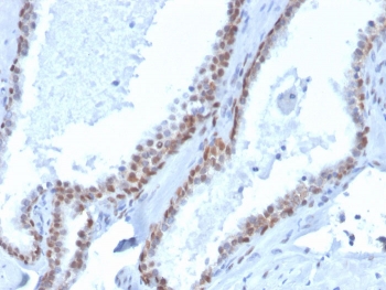p40 Antibody Biotin Conjugate. Immunohistochemistry analysis of Tumor protein p40 (deltaNp63) in FFPE human prostate tissue using a p40 Antibody Biotin Conjugate (clone rTP40/3690) demonstrates strong HRP-DAB brown nuclear staining in basal epithelial cells lining glandular structures, while luminal secretory cells remain negative. The staining forms a continuous basal layer pattern outlining prostate glands, consistent with the known localization of deltaNp63 in basal cell compartments. The biotin-streptavidin detection system enhances signal intensity, resulting in crisp nuclear staining with clear contrast against surrounding stromal tissue. This pattern supports accurate identification of basal cell populations and epithelial organization within prostate tissue. Heat-induced epitope retrieval was performed by boiling tissue sections in pH 9 10mM Tris with 1mM EDTA for 20 minutes followed by cooling prior to antibody incubation.