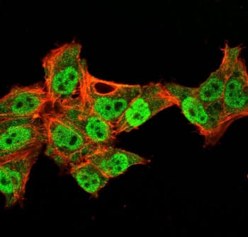 p40 Antibody for IF. Immunofluorescence analysis of PFA-fixed and permeabilized human HeLa cells using a p40 Antibody for IF (clone TP40/3980R) demonstrates strong green nuclear staining corresponding to Tumor protein p40 (deltaNp63), while Phalloidin (red) highlights actin cytoskeletal structures in the cytoplasm. The fluorescence signal is confined to nuclei, showing clear subcellular localization of deltaNp63 as a transcription factor, with minimal cytoplasmic background. The sharp nuclear definition and strong signal intensity are consistent with high-affinity binding of the recombinant rabbit monoclonal antibody, enabling precise visualization of p40-positive cells. The distinct separation between nuclear p40 signal and cytoskeletal staining supports accurate interpretation of epithelial cell identity and intracellular organization in immunofluorescence-based imaging.