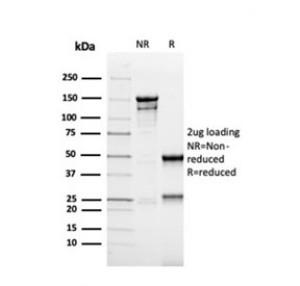 MSH6 Antibody rMSH6/4743 Purity Analysis by SDS-PAGE. Electrophoretic analysis of purified, BSA-free MSH6 Antibody, clone rMSH6/4743, to evaluate antibody purity and integrity. The observed antibody protein pattern supports the purity and integrity of the recombinant monoclonal antibody preparation.