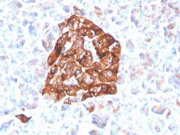 Synaptophysin Antibody Recombinant Rabbit MAb Clone SYP/4503R. Immunohistochemistry analysis of FFPE human pancreas tissue shows strong cytoplasmic HRP-DAB brown staining in pancreatic islet cells, consistent with Synaptophysin (SYP) localization in neuroendocrine secretory vesicles. Positive staining highlights endocrine cells within the islets of Langerhans, while surrounding exocrine pancreatic tissue shows minimal staining. Hematoxylin counterstain marks nuclei in blue. The recombinant rabbit monoclonal Synaptophysin antibody clone SYP/4503R was used to detect synaptic vesicle protein expression in human pancreatic neuroendocrine cells. Heat-induced epitope retrieval was performed by boiling tissue sections in pH 9 10mM Tris with 1mM EDTA for 20 minutes followed by cooling prior to staining.