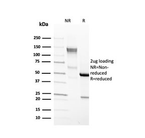 SDS-PAGE analysis of purified, BSA-free recombinant EpCAM antibody (clone EGP40/4546R) as confirmation of integrity and purity.