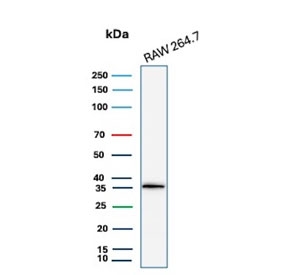 Western blot testing of mouse RAW264.7 cell lysate with recombinant Cyclin D1 antibody. Predicted molecular weight: 32-36 kDa.