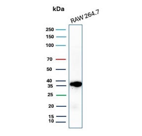 Western blot testing of mouse RAW264.7 cell lysate with recombinant Cyclin D1 antibody. Predicted molecular weight: 32-36 kDa.