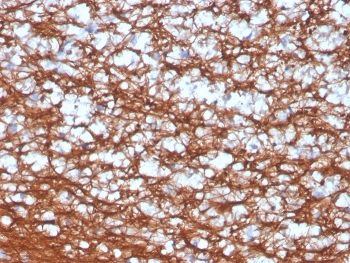 PGP9.5 Antibody / Neuronal Structure Marker Antibody. Immunohistochemistry analysis of PGP9.5 / UCHL1 in FFPE human cerebellum. IHC staining of FFPE human cerebellum using PGP9.5 Antibody / Neuronal Structure Marker Antibody highlights dense neuronal networks with strong HRP-DAB brown cytoplasmic staining extending along neurites and axonal processes. The staining outlines interconnected nerve fiber architecture within cerebellar tissue, with prominent labeling of neuronal cell bodies and extensive neuritic branching, while surrounding non-neuronal cells show minimal signal. Clone UCHL1/4556R demonstrates clear visualization of neuronal morphology and neural connectivity, supporting detailed assessment of tissue-level neuroanatomy.