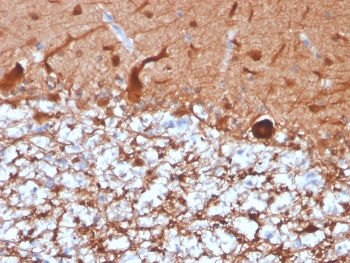 PGP9.5 Antibody / Neuronal Structure Marker Antibody. Immunohistochemistry analysis of PGP9.5 / UCHL1 in FFPE human cerebellum. Immunohistochemical staining of FFPE human cerebellum using PGP9.5 Antibody / Neuronal Structure Marker Antibody reveals extensive HRP-DAB brown cytoplasmic labeling of neuronal elements, with signal distributed along neuritic extensions and axonal fibers. The staining pattern emphasizes the layered organization of cerebellar tissue, with dense networks of nerve fibers forming a continuous mesh-like architecture and clear visualization of neuronal morphology. Clone UCHL1/4556R supports detailed assessment of neurite organization and neural tissue structure while non-neuronal regions remain largely unstained.