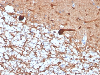 PGP9.5 Antibody / Neuroendocrine Tumor Marker Antibody. Immunohistochemistry analysis of PGP9.5 / UCHL1 in FFPE human cerebellum. Immunohistochemical staining of FFPE human cerebellum using PGP9.5 Antibody / Neuroendocrine Tumor Marker Antibody shows robust HRP-DAB brown cytoplasmic signal in neuronal cell bodies and extensive neuritic networks, consistent with the neuroendocrine-linked expression of UCHL1. The staining pattern mirrors features commonly observed in neuroendocrine tumors, where PGP9.5 is used to identify tumor cells with neuroendocrine differentiation and lineage characteristics. Clone rUCHL1/4557 enables clear visualization of neuroendocrine-associated cellular morphology while surrounding non-neuronal cells display minimal background staining.