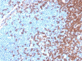 CD4 Antibody for IHC. Analysis of CD4 antibody staining in FFPE human lymph node tissue shows strong membranous labeling of CD4-positive T helper lymphocytes predominantly within paracortical regions, with relative sparing of B cell follicles, highlighting T cell-rich zones within lymphoid tissue. This T Cell Activation Marker Antibody (clone rCD4/3930) demonstrates clear detection of activated T cell populations consistent with CD4-mediated immune activation. Heat-induced epitope retrieval was performed by boiling tissue sections in pH 9 10 mM Tris with 1 mM EDTA for 20 minutes followed by cooling before testing.