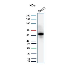 Western blot testing of human tonsil tissue with recombinant CD4 antibody (clone rCD4/3930). Expected molecular weight: 50-55 kDa.