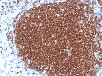 IHC staining of FFPE human lymph node with CD19 antibody. HIER: boil tissue sections in pH 9 10mM Tris with 1mM EDTA for 20 min and allow to cool before testing.