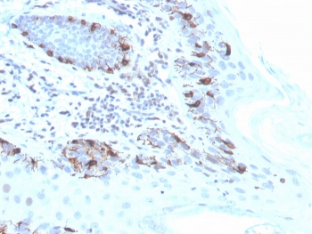 IHC staining of FFPE human skin with recombinant MART-1 antibody (clone MLANA/4475R). HIER: boil tissue sections in pH 9 10mM Tris with 1mM EDTA for 20 min and allow to cool before testing.