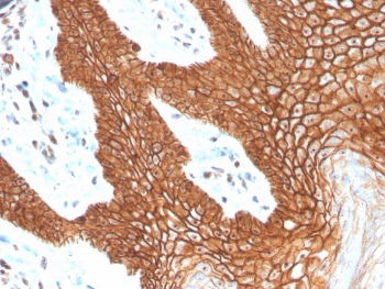 E-cadherin Antibody Human Cervix IHC. Immunohistochemistry analysis of Cadherin 1 / CDH1 expression in FFPE human cervix tissue using protein microarray validated clone CDH1/4398R antibody, showing strong membranous HRP-DAB brown staining in epithelial cells with clear cell-cell junction localization, while surrounding stromal cells remain largely negative. HIER: boil tissue sections in pH 9 10mM Tris with 1mM EDTA for 20 min and allow to cool before testing. Signal highlights epithelial layer organization and adherens junction integrity.