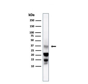 DAZL Antibody Testis WB. Western blot analysis of human testis lysate using DAZL Antibody / Germ Cell Marker Antibody (clone DAZL/4253) demonstrates a prominent immunoreactive band at approximately 30-35 kDa, consistent with expression of DAZL. DAZL is a conserved RNA-binding protein that regulates germline specification, germ cell differentiation, and reproductive development through post-transcriptional control of mRNA translation. Expression of DAZL is primarily associated with germ cell populations and developing reproductive tissues, making it a widely utilized marker of germline lineage commitment and fertility-associated pathways. The observed band migrates close to the predicted molecular weight of approximately 32 kDa and is consistent with endogenous DAZL expression in human testis tissue. Predicted molecular weight: approximately 32 kDa. Observed molecular weight: approximately 30-35 kDa.