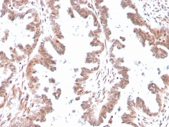 GDF9 Antibody Human Ovary Tissue IHC. Immunohistochemistry staining of FFPE human ovary with GDF9 antibody. HIER: boil tissue sections in pH 9 10mM Tris with 1mM EDTA for 20 min and allow to cool before testing.