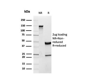 SDS-PAGE analysis of purified, BSA-free monoclonal Inhibin alpha antibody as confirmation of integrity and purity.