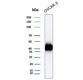 Western blot testing of human OVCAR-3 cell lysate with specificity validated MSLN antibody. Predicted molecular weight ~70 kDa (precursor), ~40 kDa (processed form).