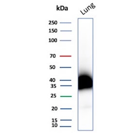 Western blot testing of human lung tissue lysate with recombinant Podoplanin antibody. Predicted molecular weight ~25 kDa but may be observed at higher molecular weights due to glycosylation.