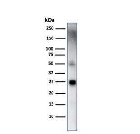 Western blot testing of human spleen lysate with TIM3 antibody. Expected molecular weight: 33-70 kDa depending on glycosylation level.
