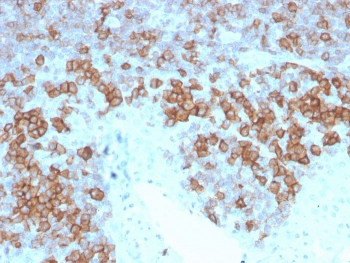 CD27 Antibody for IHC. Immunohistochemistry analysis of CD27 / TNFRSF7 expression in FFPE human tonsil tissue using Protein Microarray Specificity Validated CD27 Antibody clone LPFS2/4177. Strong membranous HRP-DAB brown staining is observed in lymphocyte populations within tonsillar germinal centers and interfollicular regions, consistent with CD27 expression on activated and memory T and B cells, while surrounding non-lymphoid structures remain largely negative. The staining pattern supports selective target recognition and highlights immune cell compartmentalization within lymphoid tissue. Heat-induced epitope retrieval was performed in pH 9 10 mM Tris with 1 mM EDTA for 20 minutes followed by cooling prior to antibody incubation.