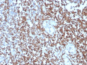 IHC staining of FFPE human tonsil with CD27 antibody (clone LPFS2/4177). HIER: boil tissue sections in pH 9 10mM Tris with 1mM EDTA for 20 min and allow to cool before testing.
